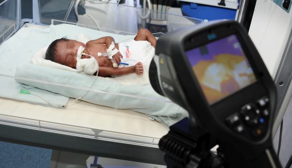 Dokunmadan uzaktan teshis