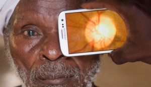 Peek Retina ile Telefonla Göz Testi Yapılmaya Başlandı 21 Retinal imaging