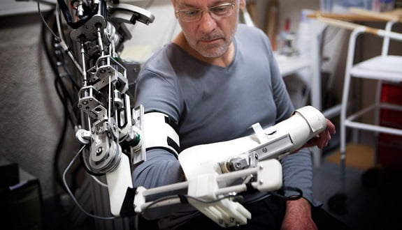 Zihin Gücüyle Kontrol Edilen Robotik Uzuv! 1 robotik uzuv