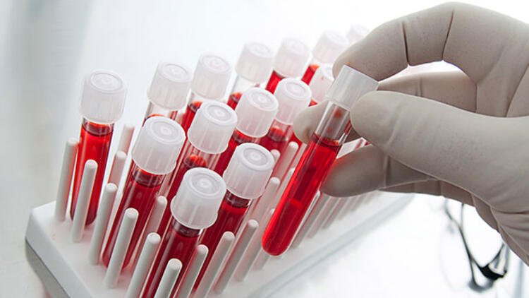 Artık otobüse binmek için de PCR testi istenecek