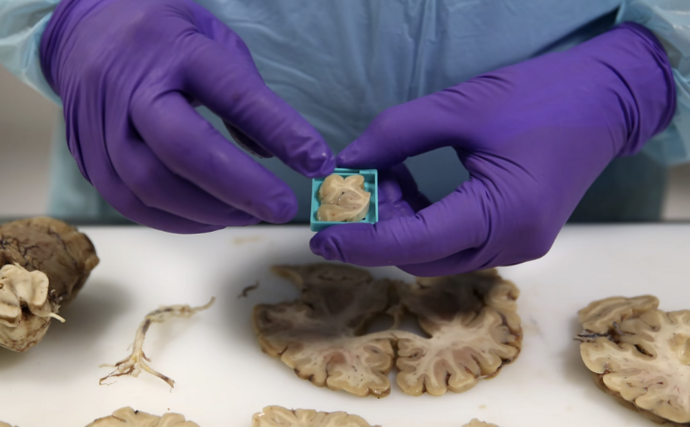 Bilim İnsanları Minik Beyinler Üretti!