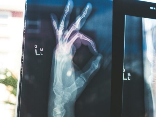 google open source ai models medgemma healthcare artificial intelligence health medicine 1024x768 1