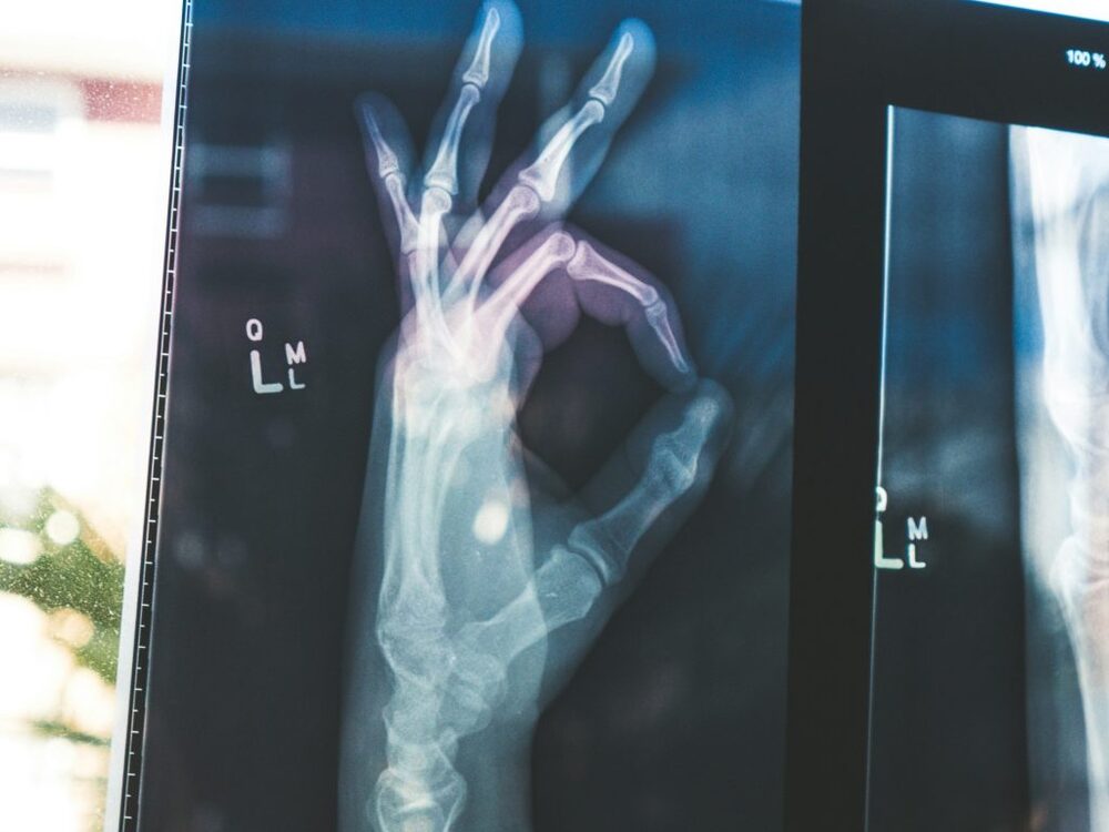 google open source ai models medgemma healthcare artificial intelligence health medicine 1024x768 1