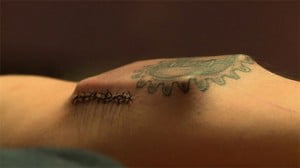 Çılgın Adam Yardım Almaksızın Kolunun İçine Bir Bilgisayar Yerleştirdi 9 originalsss